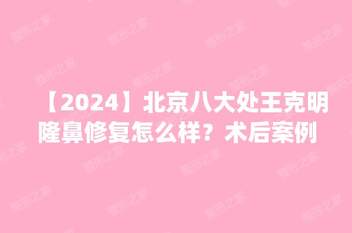 【2024】北京八大处王克明隆鼻修复怎么样？术后案例|价格分享