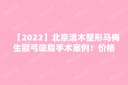 【2024】北京清木整形马梅生颧弓吸脂手术案例！价格一览+术后效果案例