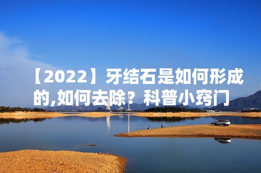 【2024】牙结石是如何形成的,如何去除？科普小窍门缓解口臭!