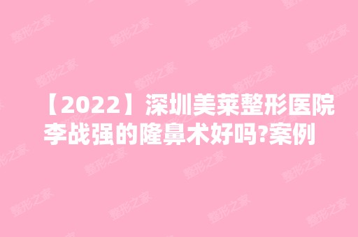 【2024】深圳美莱整形医院李战强的隆鼻术好吗?案例效果分享