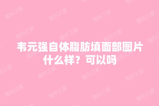 韦元强自体脂肪填面部图片什么样？可以吗