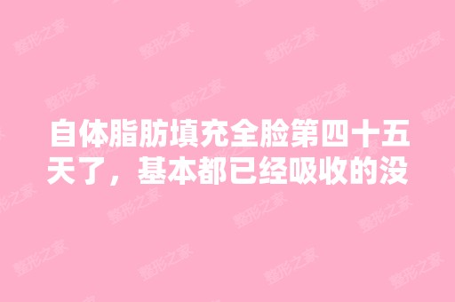 自体脂肪填充全脸第四十五天了，基本都已经吸收的没