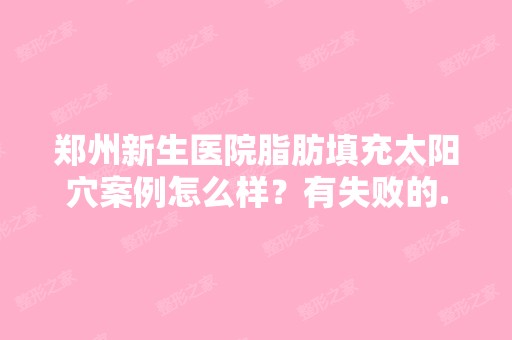 郑州新生医院脂肪填充太阳穴案例怎么样？有失败的...