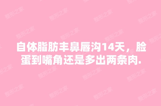 自体脂肪丰鼻唇沟14天，脸蛋到嘴角还是多出两条肉...