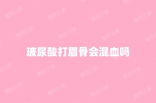 玻尿酸打眉骨会混血吗