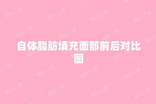 自体脂肪填充面部前后对比图