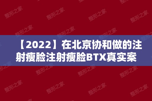 【2024】在北京协和做的注射瘦脸注射瘦脸BTX真实案例分享，并有术后恢复效果图呈上